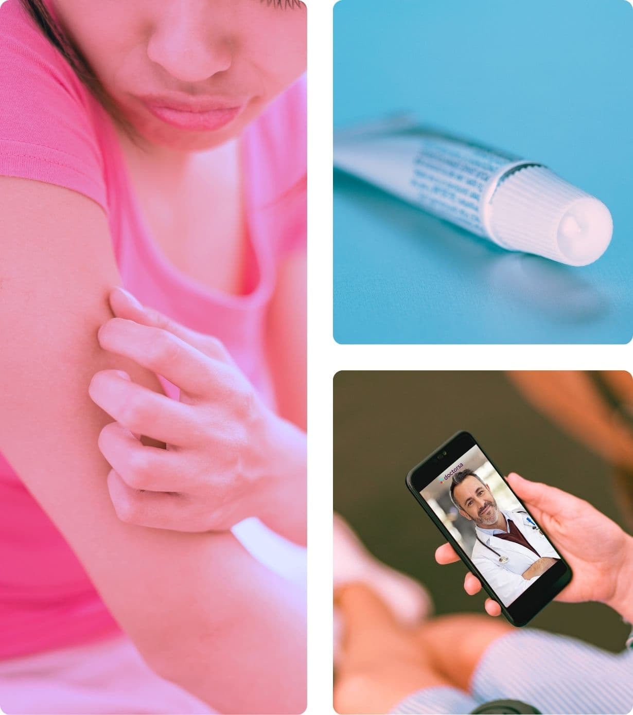 Collage showing impetigo treatment online: a person scratching their arm, a tube of antibiotic ointment, and a video consultation with a doctor on a mobile phone. These represent the ease and accessibility of online treatment for impetigo.